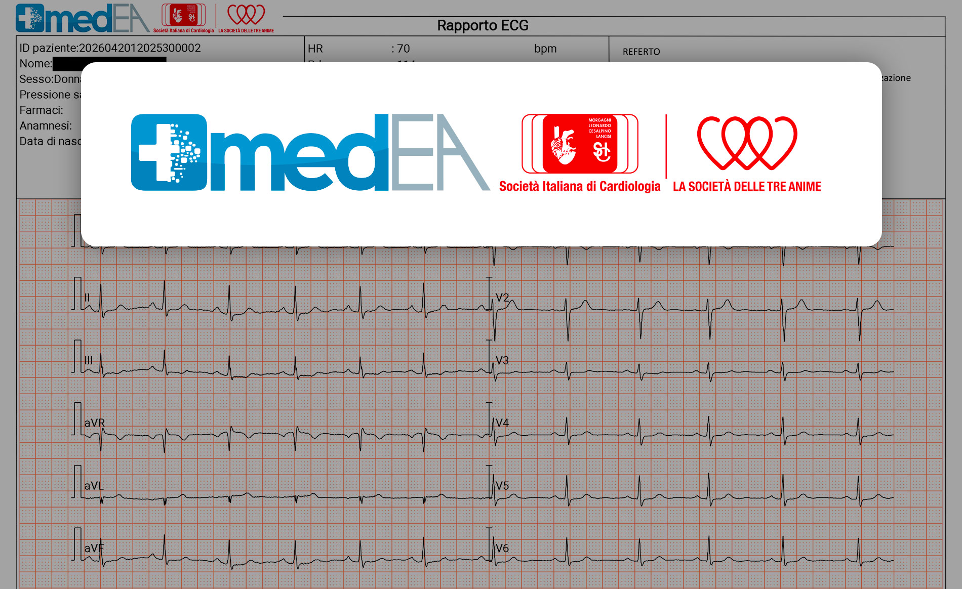 Telemedicina in farmacia, dalla SIC il primo “bollino di qualità” e standard da ambulatorio ospedaliero per la refertazione cardiologica